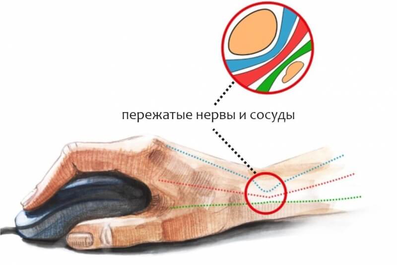 Кракен дарк ссылка